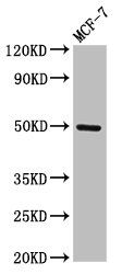 TWIST1 Antibody