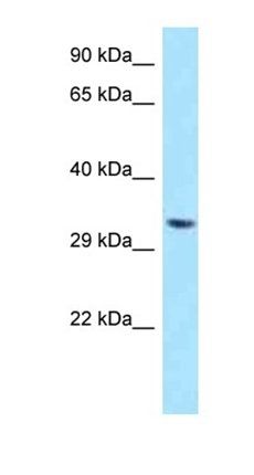 TWISTNB antibody