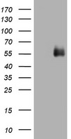 TXNDC (TMX1) antibody