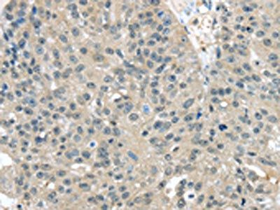 TXNDC17 Antibody