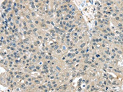 TXNDC17 antibody