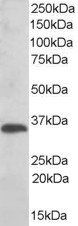 Goat anti-TXNDC1 / TMX Antibody
