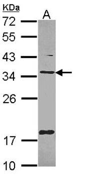TXNDC1 antibody