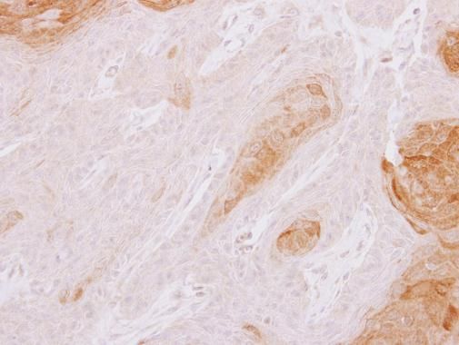 TXNDC3 antibody [N3C3]
