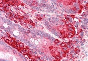 Goat anti-EndoPDI / TXNDC5 Antibody