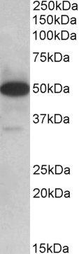 Goat anti-TXNDC5 (aa281-295) Antibody