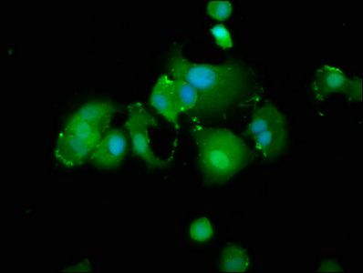 TXNIP Antibody
