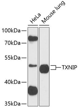 TXNIP antibody