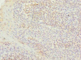 TXNL4B Antibody