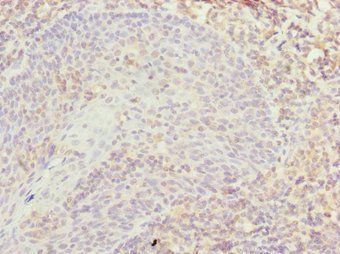 TXNL4B Antibody