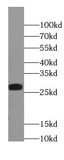 TXNL6 antibody