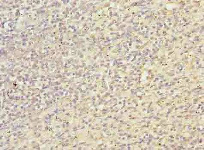 TXNRD1 antibody