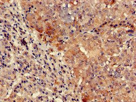 TYK2 Antibody