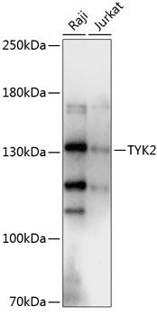 TYK2 antibody