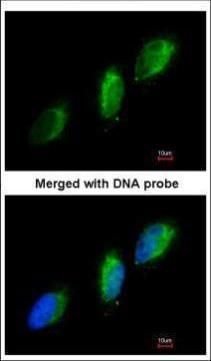 TYK2 Rabbit Polyclonal Antibody