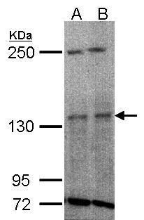 TYK2 Rabbit Polyclonal Antibody