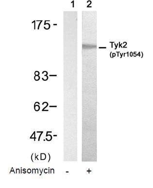 TYK2 (Phospho-Tyr1054) Antibody