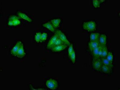 Type I inositol 1, 4, 5-trisphosphate 5-phosphatase antibody