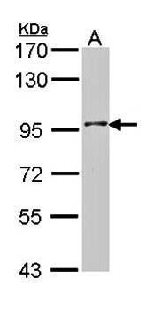 Type II 5-phosphatase antibody
