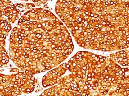 TYR Antibody