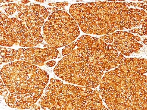 TYR Antibody
