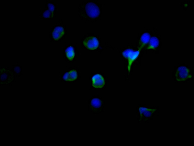 TYR Recombinant Monoclonal Antibody