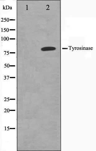Tyrosinase antibody
