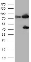 Tyrosine Hydroxylase (TH) antibody