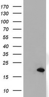 Tyrosine Hydroxylase (TH) antibody