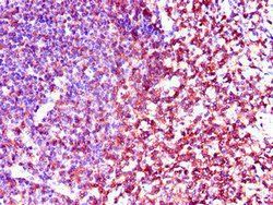 LCK Antibody