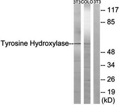 Tyrosine Hydroxylase (Ab-19) Antibody