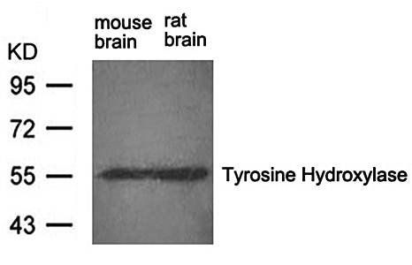 Tyrosine Hydroxylase (Ab-31) Antibody
