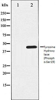 Tyrosine Hydroxylase (Phospho-Ser19) antibody