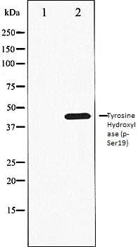 Tyrosine Hydroxylase (phospho-Ser19) antibody