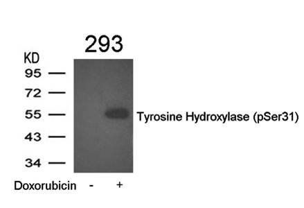 Tyrosine Hydroxylase (Phospho-Ser31) Antibody