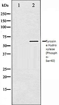 Tyrosine Hydroxylase (Phospho-Ser40) antibody