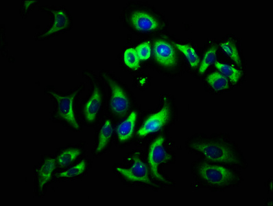 TYRP1 antibody