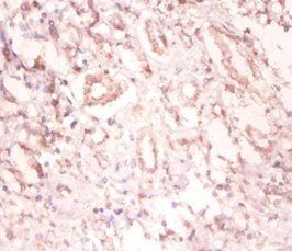 SNRPA Antibody