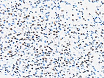 UBA1 Antibody