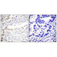 UBA2 antibody