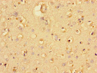 UBA6 Antibody