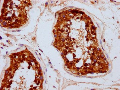 UBAC2 Antibody