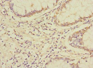 UBAP1 Antibody