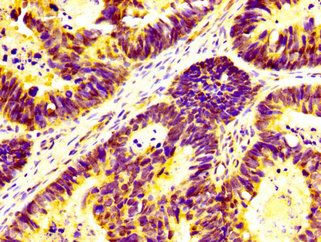 UBAP2L Antibody