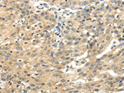 UBAP2L Antibody