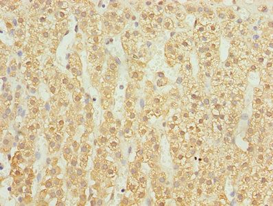 UBASH3B antibody