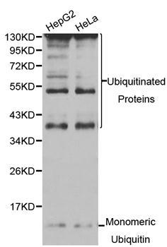 UBC antibody