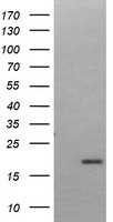 UBC6e (UBE2J1) antibody