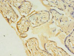 UBE2C Antibody
