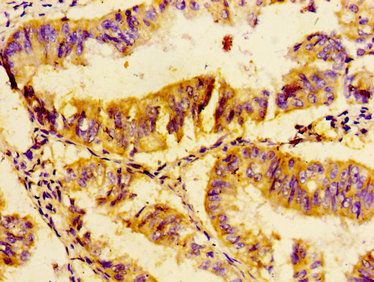 UBE2D2 Antibody